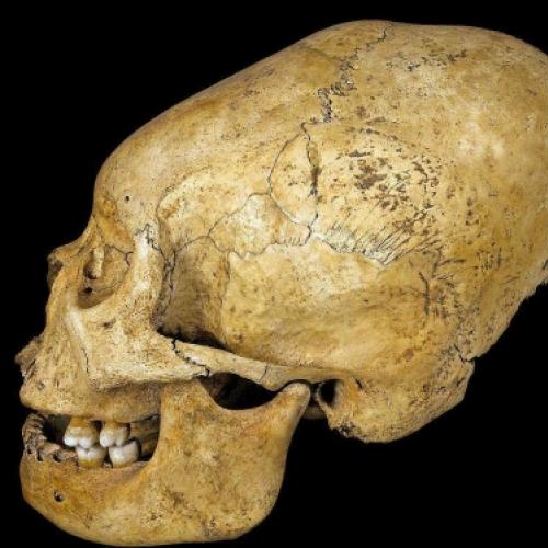 A Modificação de crânios era uma marca de status no Perú antigo.