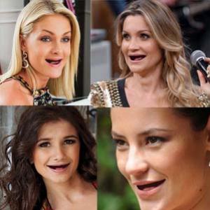 E se as mais lindas celebridades brasileiras fossem banguelas?