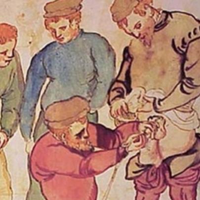 Dez agonizantes tratamentos da Idade Média