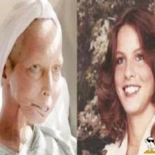  A incrível transformação da mulher que fumou por 40 anos! 