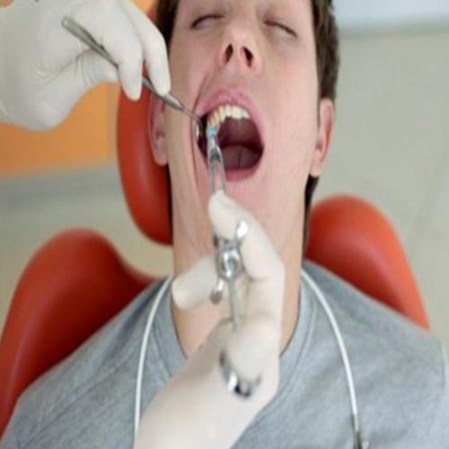 Será necessário Extrair os dentes do SISO ?