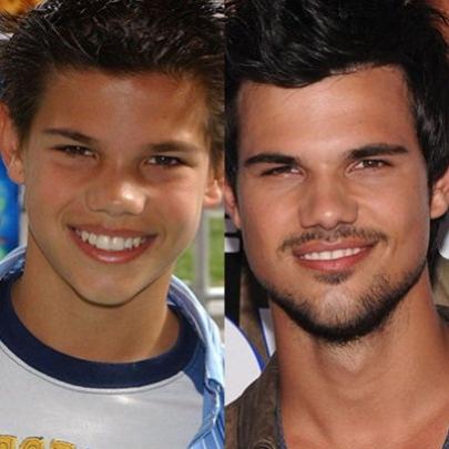Veja o antes e o depois das celebridades teen do passado