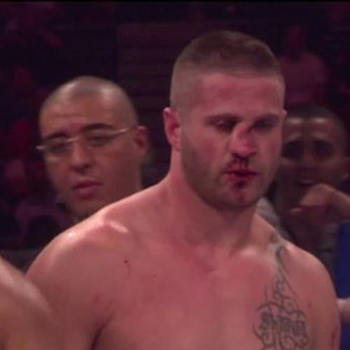 Lutador sofre uma grave lesão no nariz após uma joelhada.