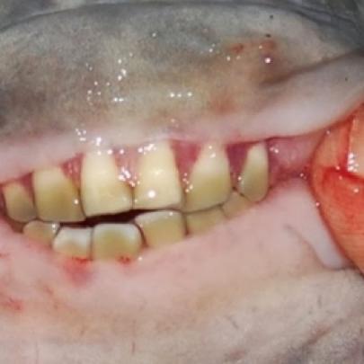 Pescadores encontraram peixe com dente humano