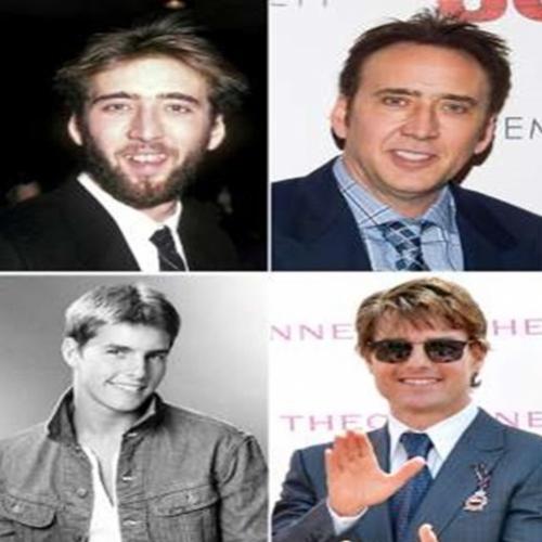Antes e depois dos sorrisos da celebridades