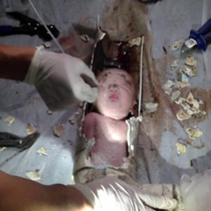 Bombeiros chineses resgatam bebê recém-nascido em cano de esgoto