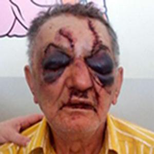 Covardia: Idoso de 74 anos é espancado por bandidos após assalto