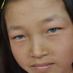 Linda chinesinha nasce com com olhos azuis é chamada de Aberração 