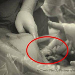 Bebê agarra dedo de médico ainda no útero da mãe e se torna viral....