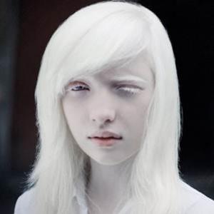  Nastya Zhidkova, a menina albina mais linda do mundo.