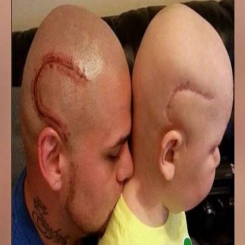 Pai tatua cicatriz igual à do filho com câncer cerebral