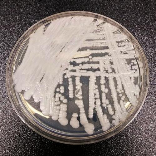 O que é Candida auris, o perigoso fungo resistente a medicamentos