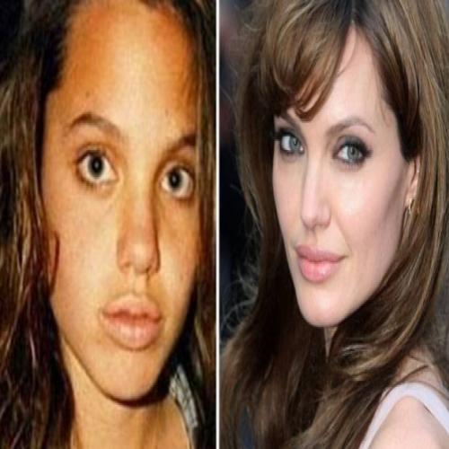 O antes e o depois dos famosos (Impressionante!)