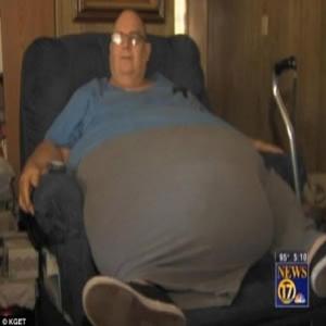 Homem de 63 anos com tumor de 90 quilos na barriga vai passar por ciru