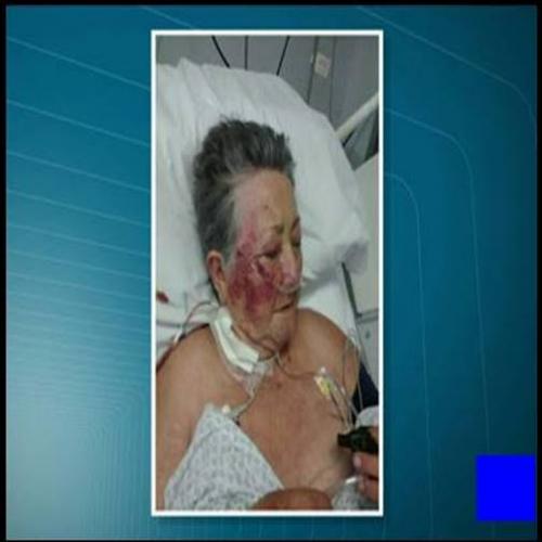 Morre idosa agredida por enfermeiro na UTI do Hospital do Servidor Mun