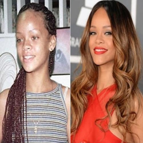 27 celebridades antes e depois da fama