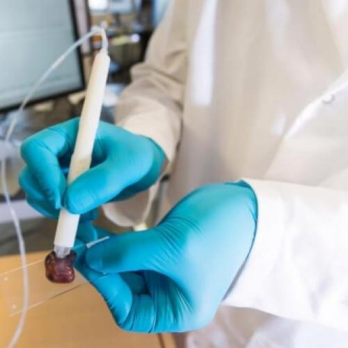 A caneta que detecta células cancerígenas em apenas 20 segundos.