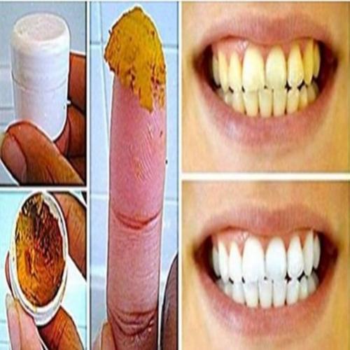 Aprenda deixar seus dentes mais brancos de uma forma barata e natural!