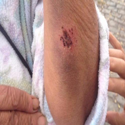 Idosa é agredida a pedradas no Rio e família denuncia intolerância