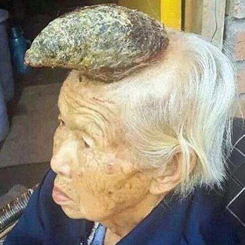 O estranho caso da ‘mulher unicórnio’ chinesa
