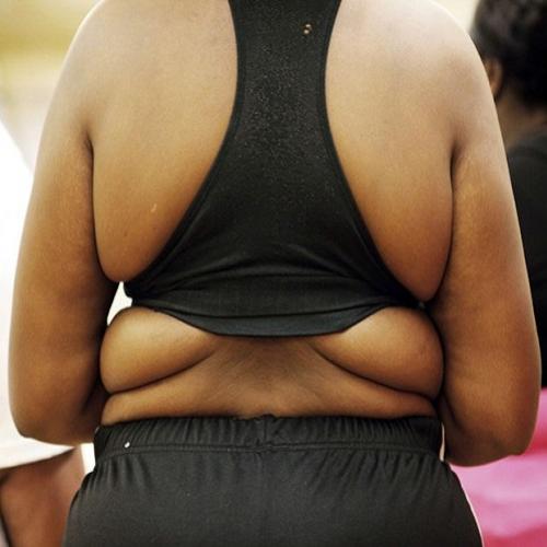 Cientistas desvendam mistério sobre como funciona gene da obesidade