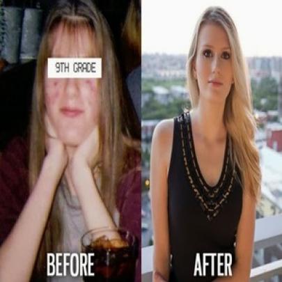 Veja o antes e depois de pessoas que eram feias e ficaram bonitas